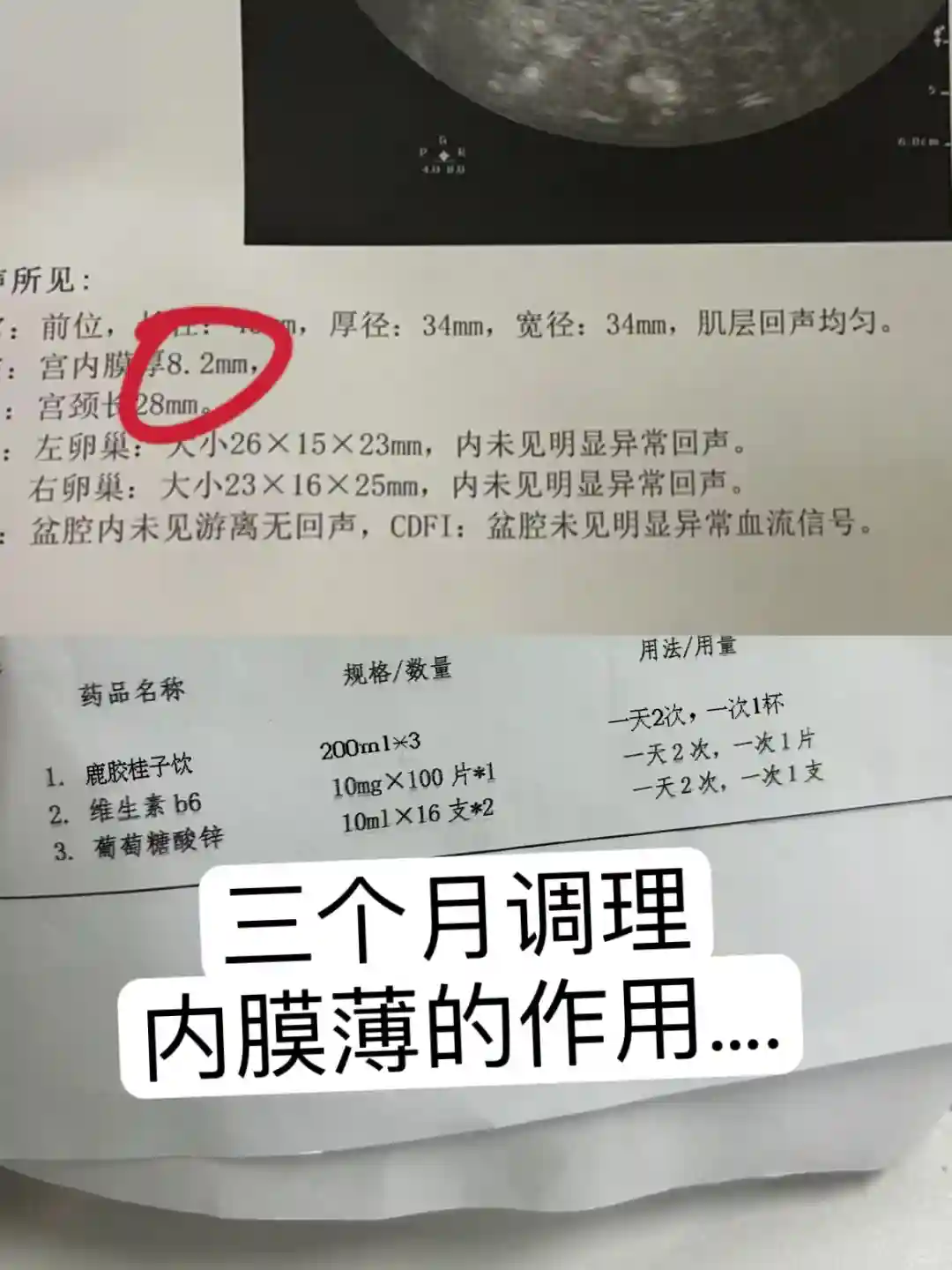 ‼️经验总结：内膜薄的如何养回来 代生中介
