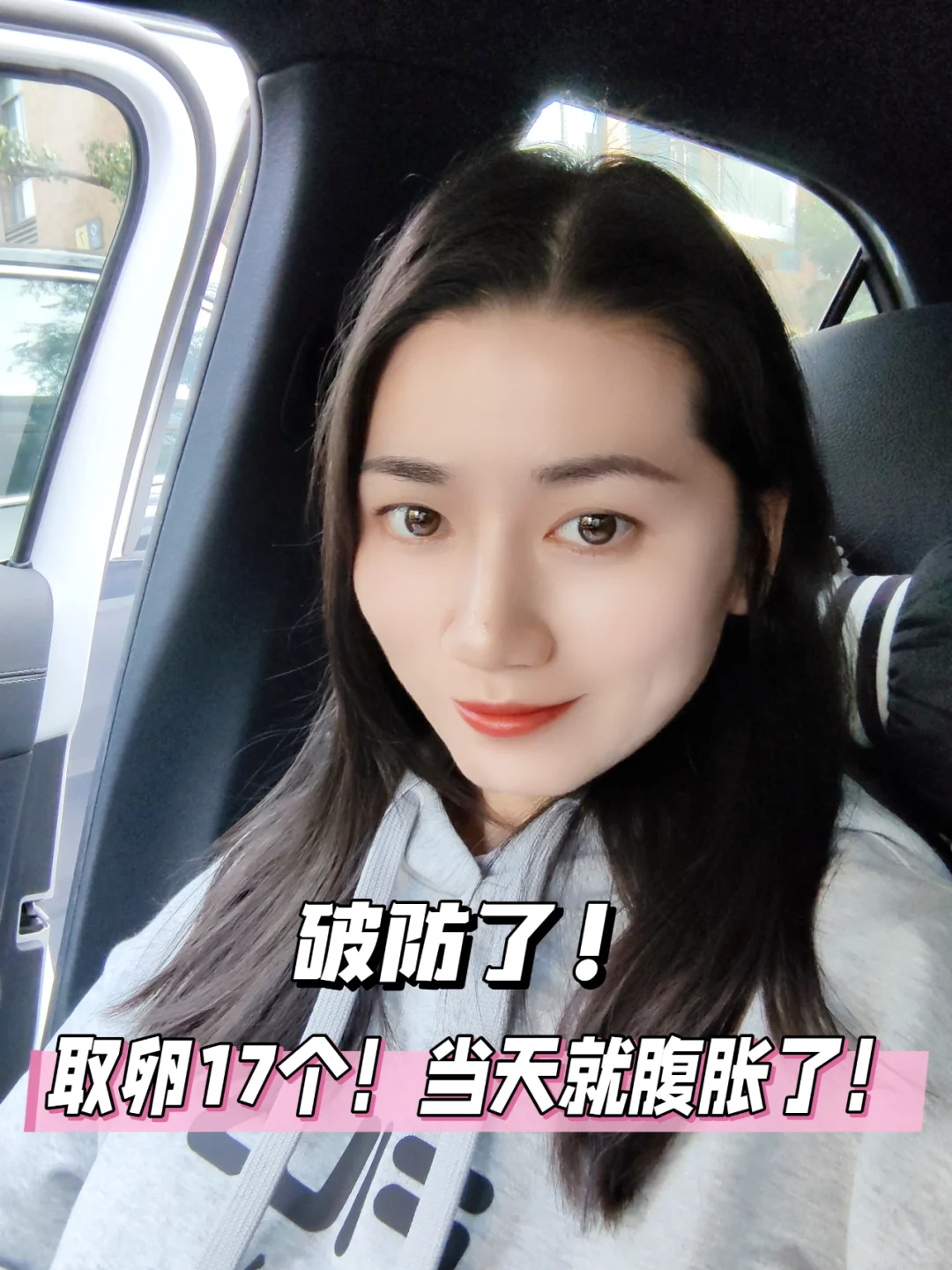 取卵后如何预防腹水？助孕移植后的注意事项与经验分享