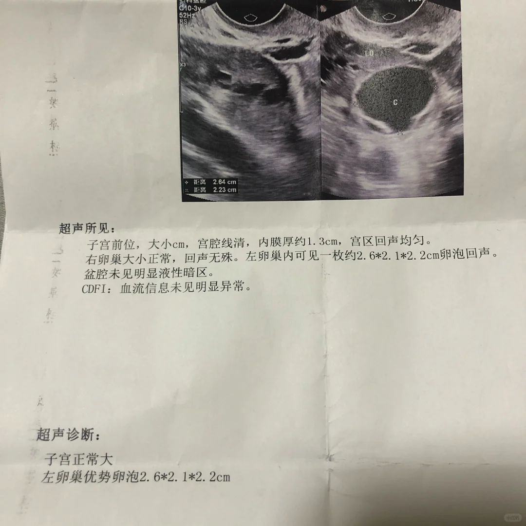 我终于有优质卵泡啦,供卵助孕机构排名榜
