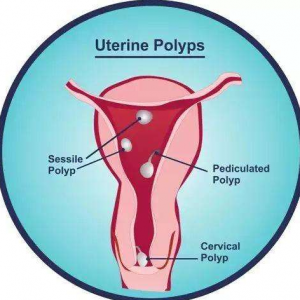 正常周期应该是多少天?月经正常多少天结束？ 试管代孕服务机构